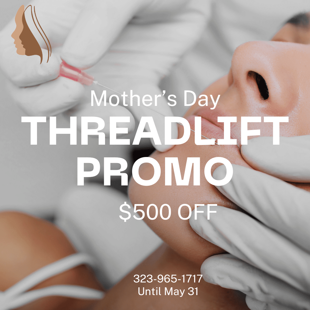 Threadlift Promo May